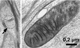 Mitokondrier i myelin vs i nerveceller