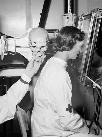 Fra en bildeserie fra 1939 som med enkle midler viser plassering av pasient og røntgenkameraets synsvinkel i samme bilde. En Røde Kors-søster har stilt opp som modell. Foto: Sæther, Røntgen-Radiuminstituttet, Rikshospitalet.