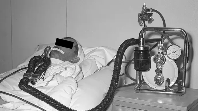 Pasient på respirator ved Rikshospitalet. Bildet er tatt på 1950-tallet da slike overtrykksrespiratorer ble vanlig i bruk. Vi vet ikke hvilken modell dette er, men den ser ut til å være gassdrevet og ikke elektrisk. 