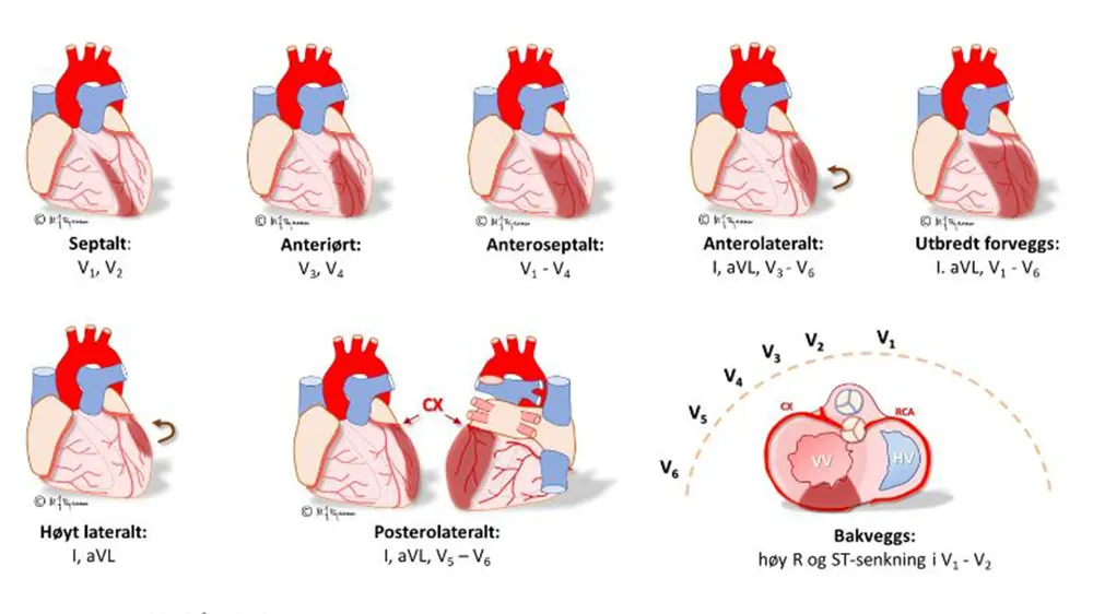 Bilde av EKG rapport